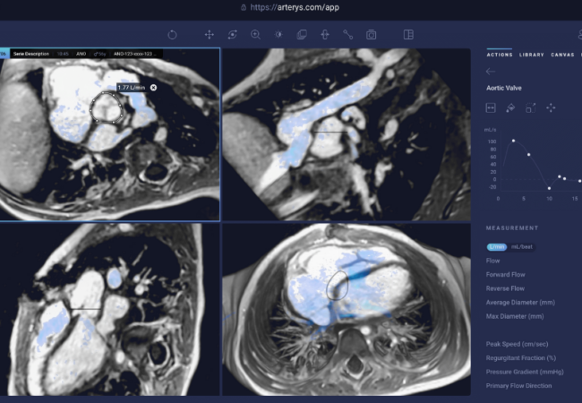 AI Medical Imaging Technology Company Arterys Raises $28 Million