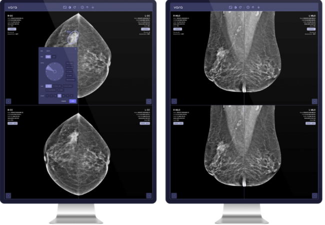 Breast Cancer Screening Startup Vara Healthcare Raises $7.5 Million