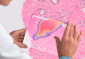 Ibex Medical Analytics Raises $38 Million for Cancer Diagnostics Platform