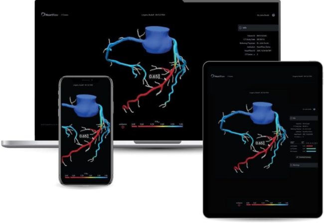 Heartflow Plans IPO via $2.4 Billion SPAC Deal