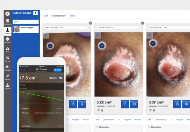 Swift Medical Raises $35 for Wound Care Management Platform