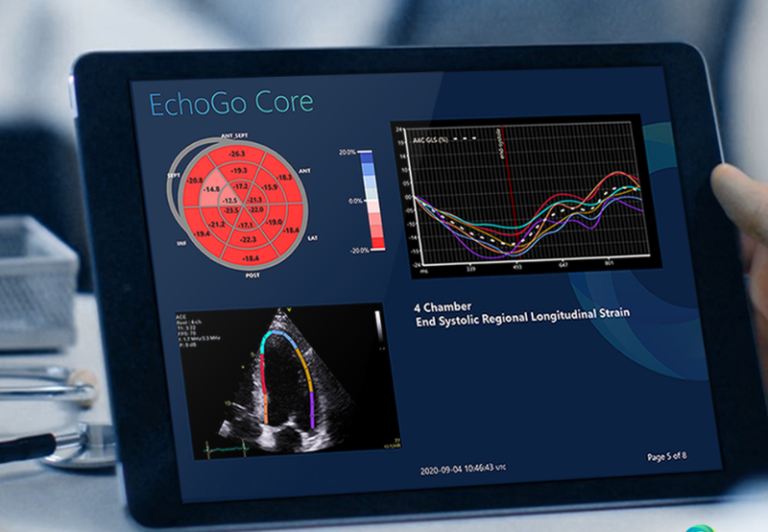 Cardiovascular Imaging Company Ultromics Raises 33 Million