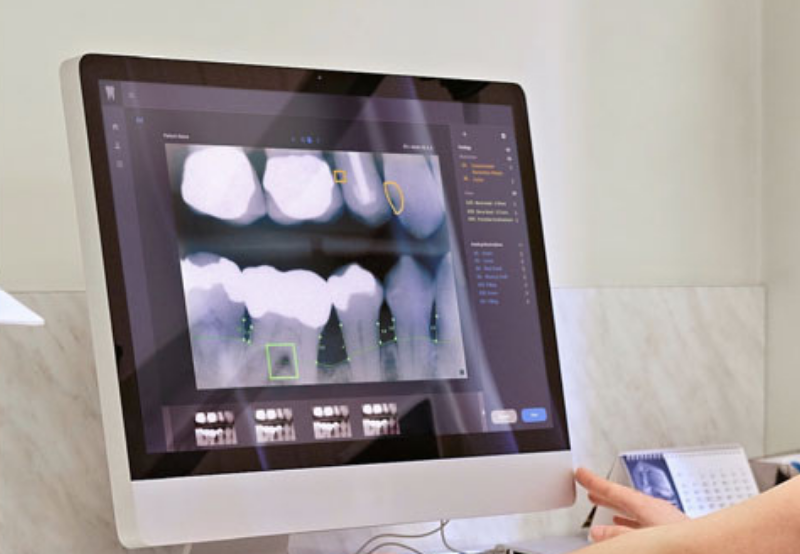 Overjet Raises $27 Million for Digital Dental Assistant Tool